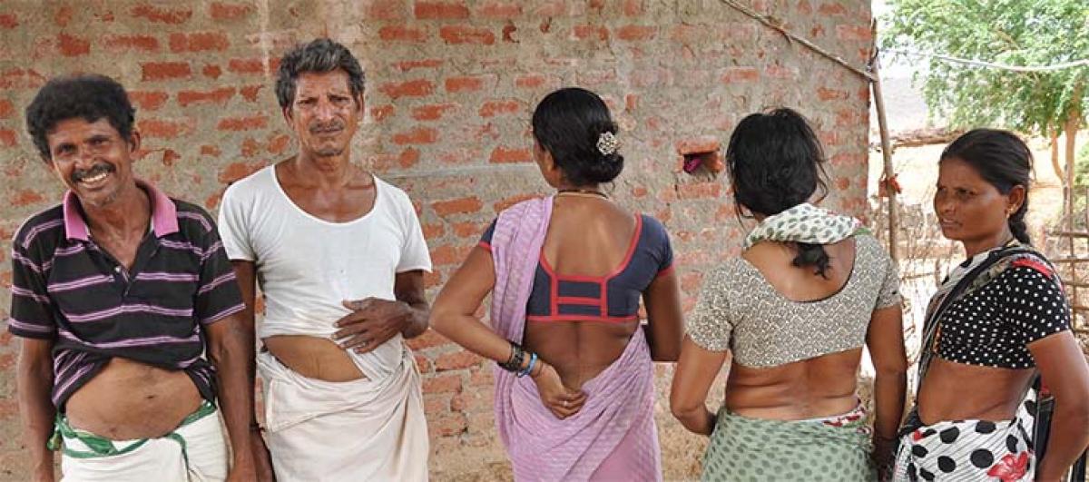 Patients who have undergone surgeries for renal problems