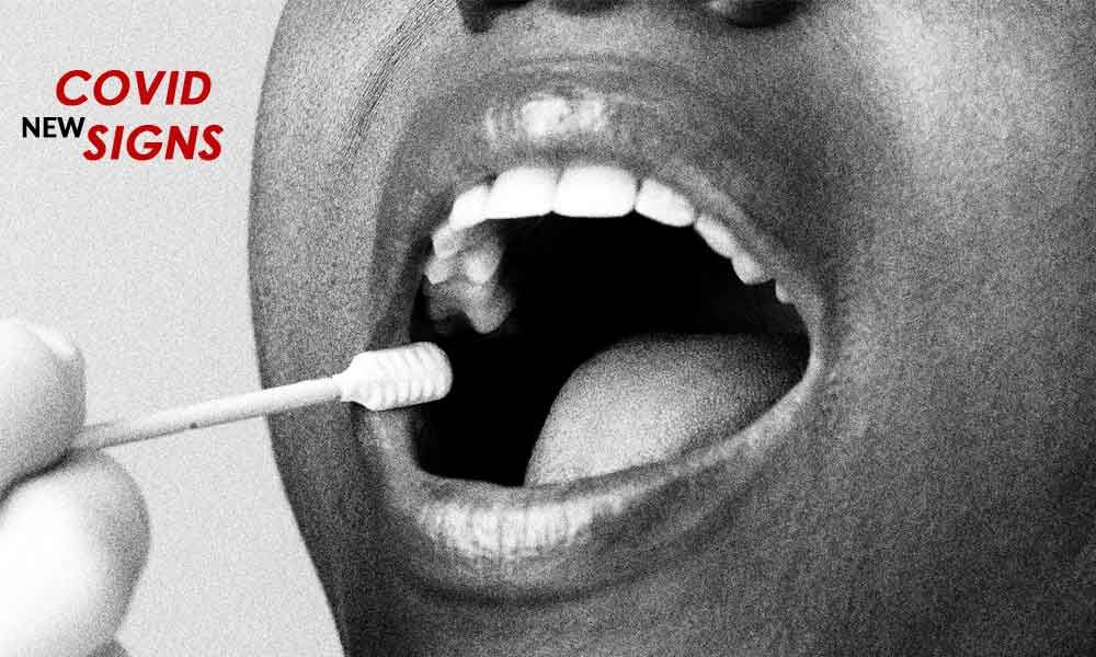 3 new Covid signs in second wave 3 new Covid signs in second wave